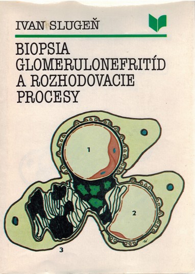 Biopsia glomerulonefritd a rozhodovacie procesy