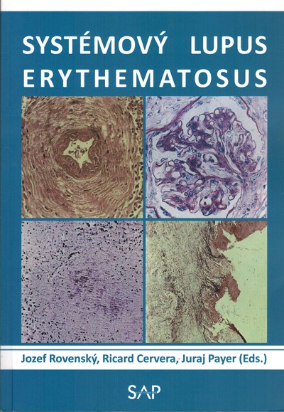 Systmov lupus erythematosus
