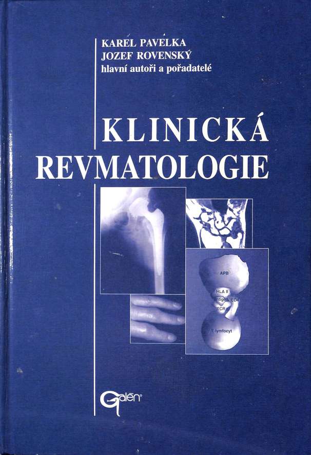 Klinick revmatologie