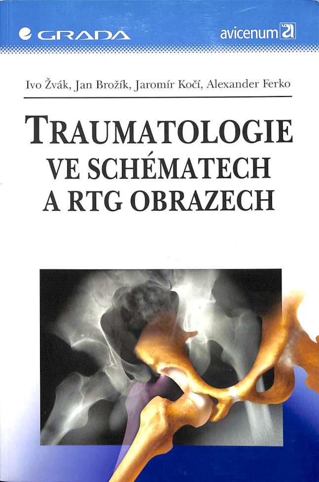 Traumatologie ve schmatech a RTG obrazech