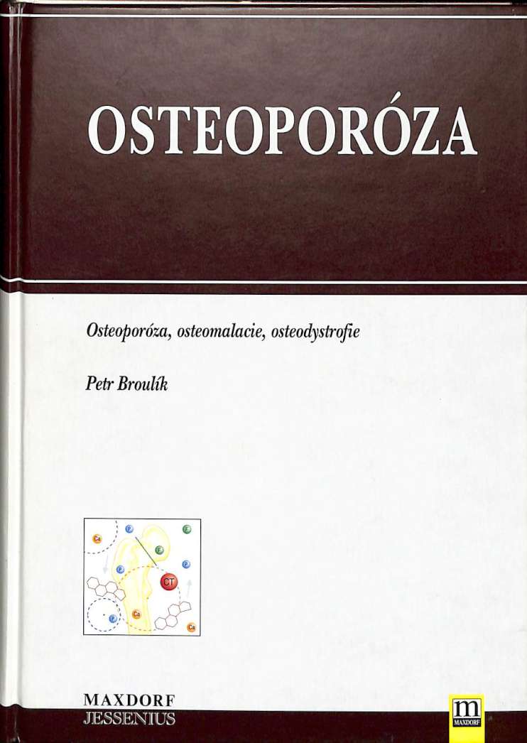 Osteoporza - Osteoporza, osteomalacie, osteodystrofie